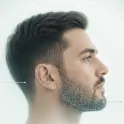 Trasplante de Barba