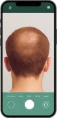 Example of a crown photo