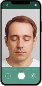 Example of a front hairline photo