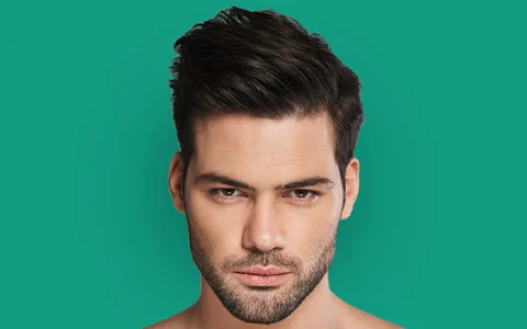 Man with full hair after an FUE transplant