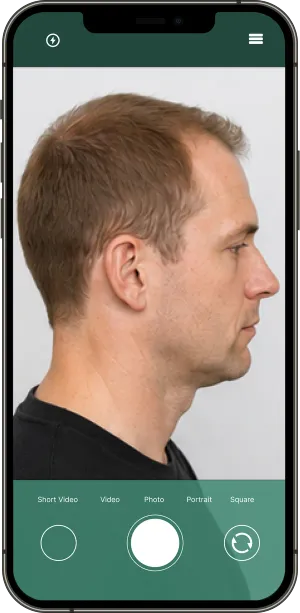 Example: Left side, Men