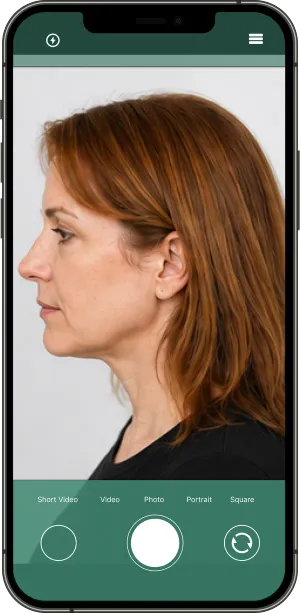 Example: Right side, Women