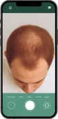 Example of a top scalp photo