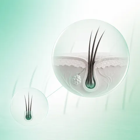 A follicular unit producing several hairs