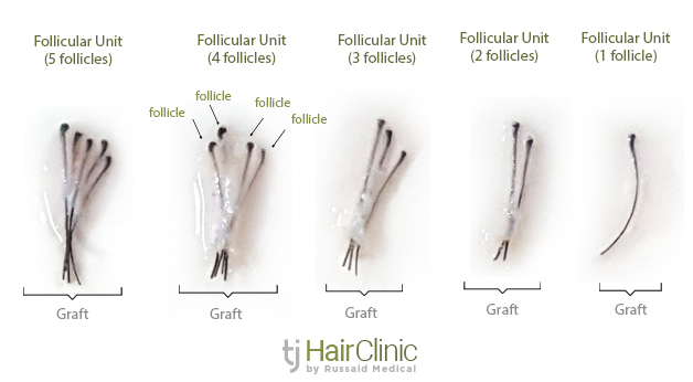 Of out why one hairs follicle grow do multiple multiple hairs